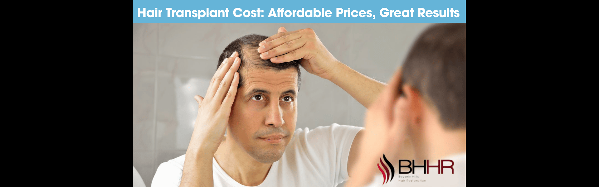 hair transplant cost (1)